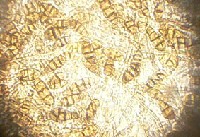 grzyby zgorzelowe jobraz mikroskopowy (wybrane)  
